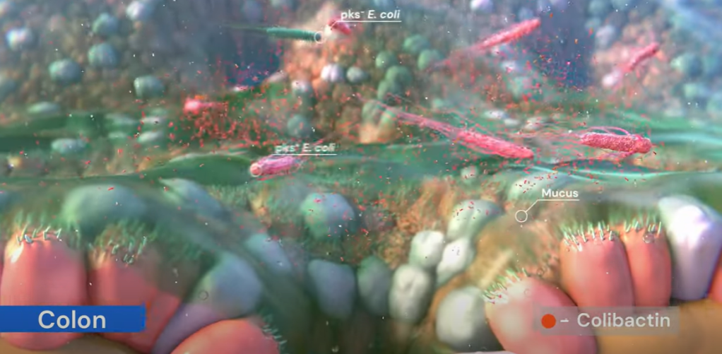 臨床・医療現場で使える英語「Geographic and age variations in mutational processes in colorectal cancer」（大腸がんの変異過程における地理的・年齢的な違い）Nature (2025年7月3日号)&nbsp;#24